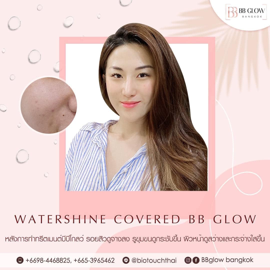 Watershine BB Glow จากประเทศเกาหลี นวัตกรรมผิวสวยใสที่ BB Glow Bangkok